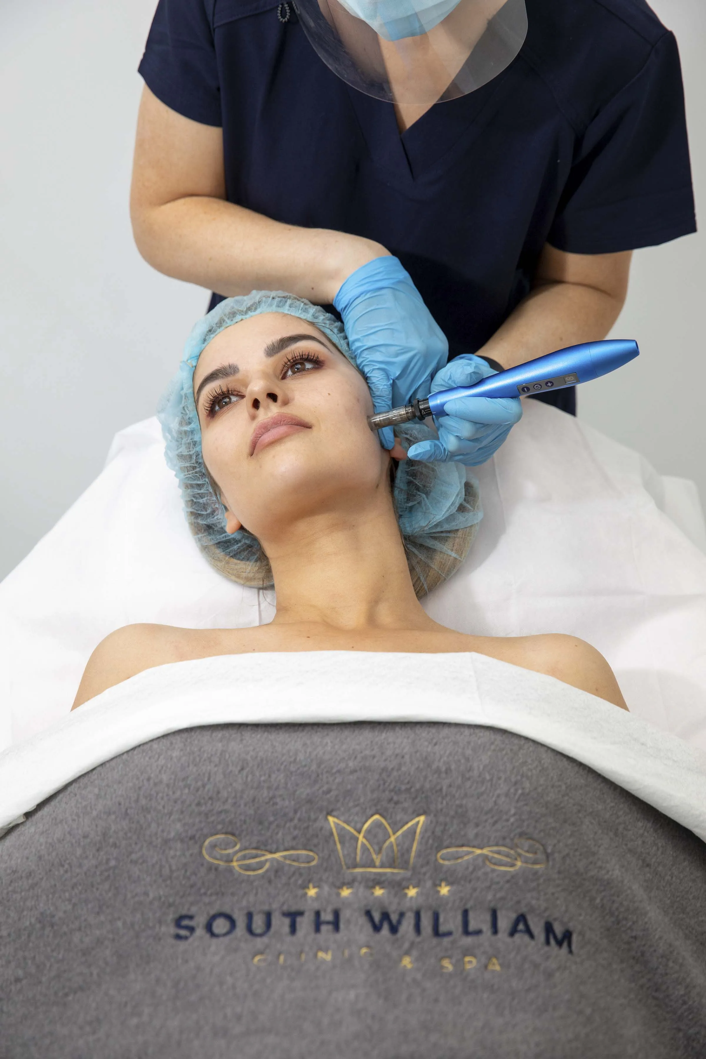 Dermapen Microneedling Skin Rejuvenation Full Face course of 4 1 FREE (save €250)