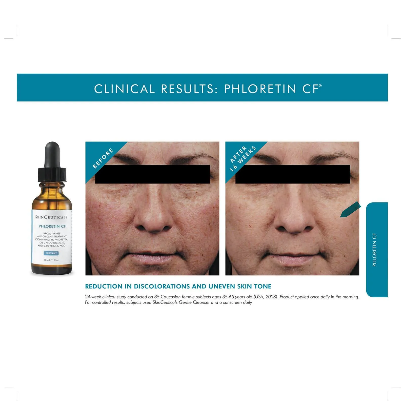 SkinCeuticals | Phloretin CF 30ml